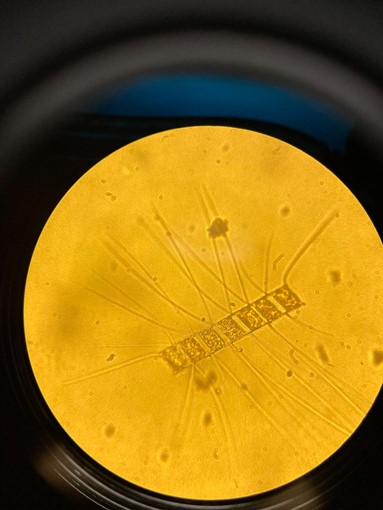 a tiny phytoplankton seen through a microscope