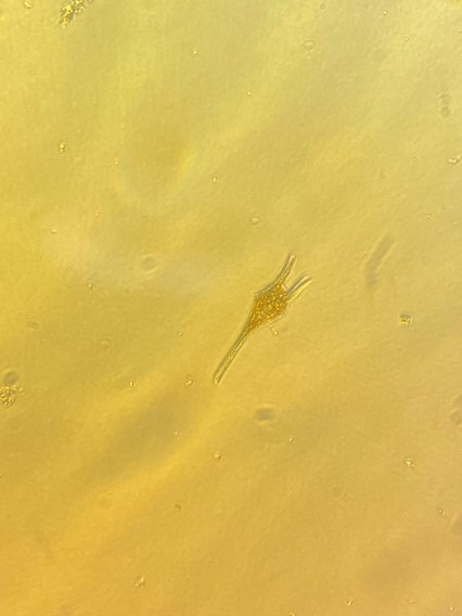 a tiny phytoplankton seen through a microscope