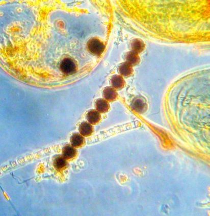 Photo of microscopic algae, Alexandrium catenella, with 11 individual cells forming a chain that resemble a beaded necklace. The A. catenella cells are round with a dark brown to reddish color and sit above a light blue background. Other cells from a water sample are partially translucent and glow yellow, these are also visible in the background.